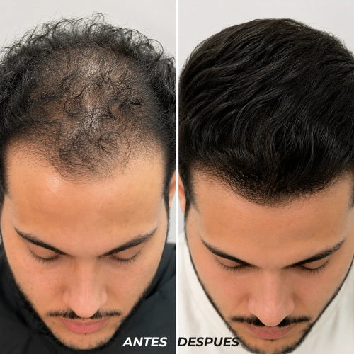 Shampoo Anticaida y Crecimiento - Ancestral Premium